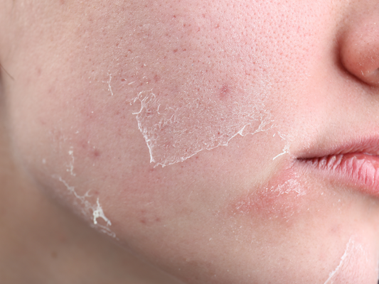 The Ultimate Guide to Luxurious Skincare for Dry Skin - Rejuvenate and Hydrate Your Way to Radiant Beauty