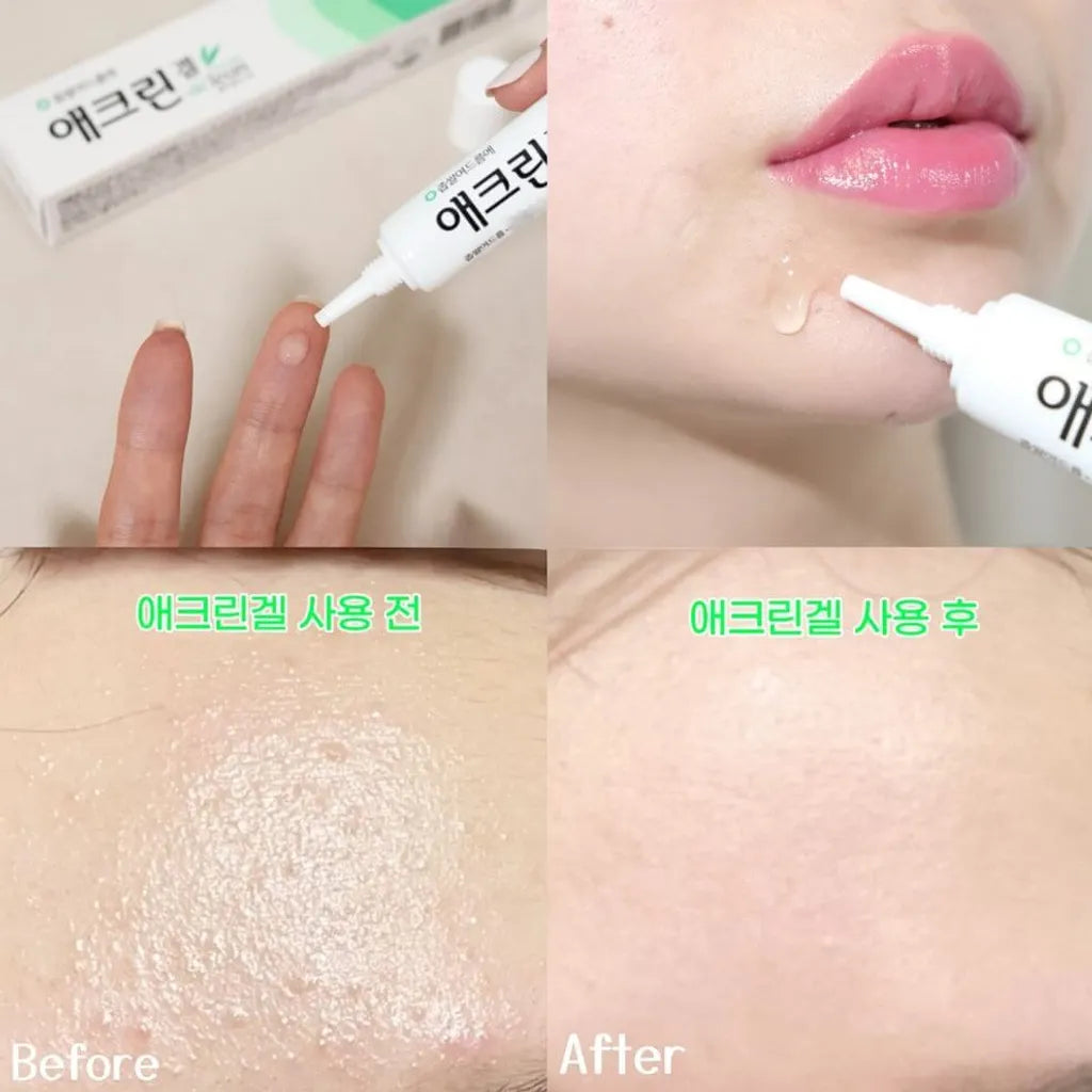 Dong-A Pharm Aclean Gel 20g
