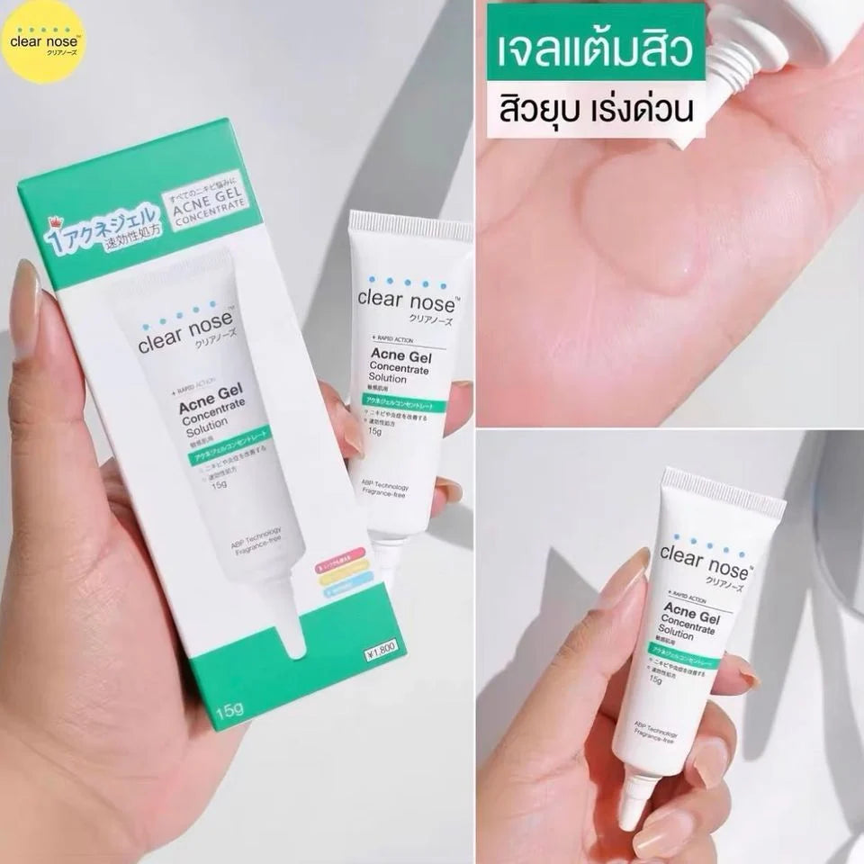 CLEAR NOSE Tea Tree Alcohol-Free Acne Gel Concentrate Solution 4g
