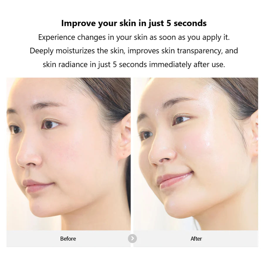 Rejuran 韓國 第二代修復水光針安瓶 30ml