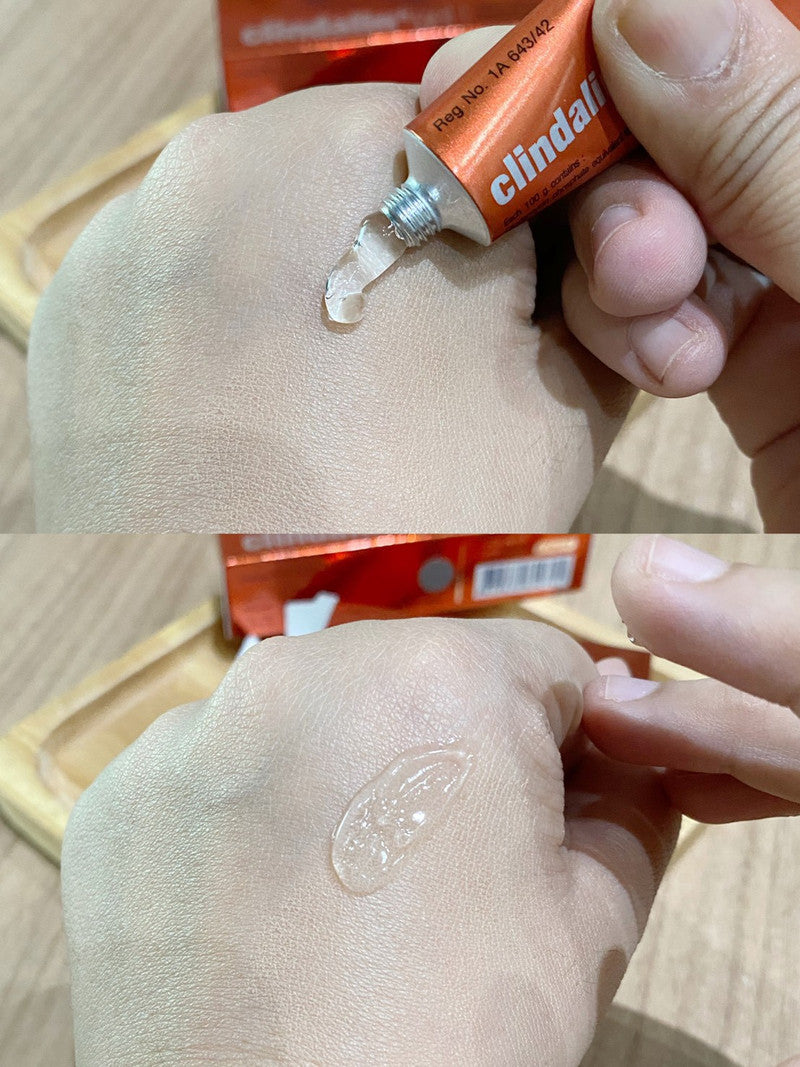Clindalin 泰國 暗瘡膏 10g