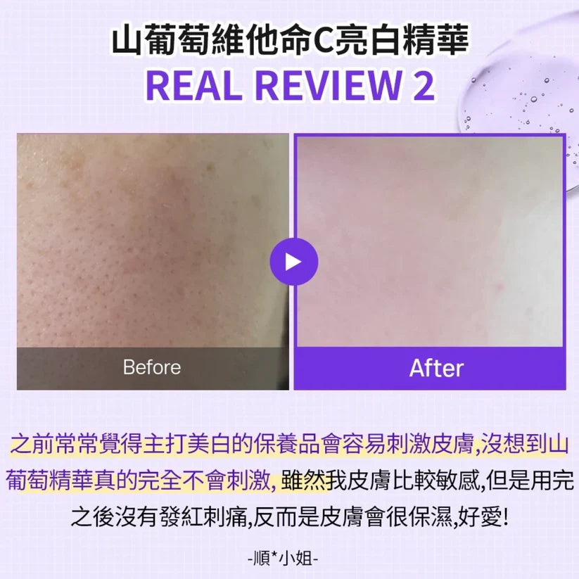 Sungboon 山葡萄維他命C 煙酰胺亮白淡斑精華 30ml
