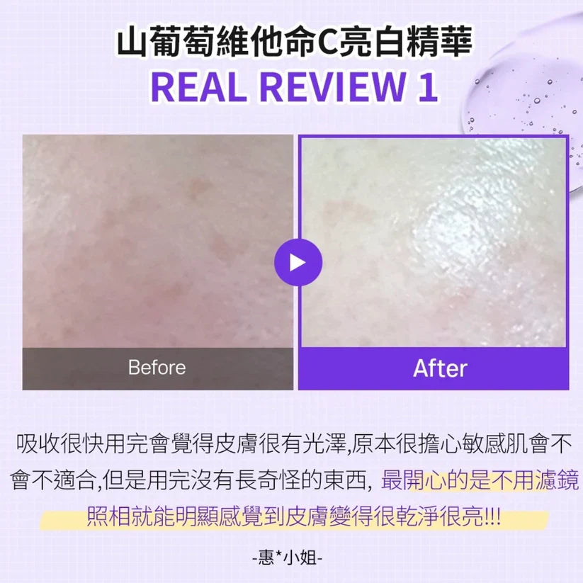 Sungboon 山葡萄維他命C 煙酰胺亮白淡斑精華 30ml