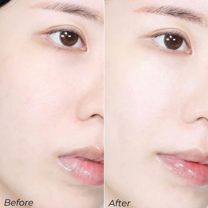 Sungboon Meoru Podo Vita C Dark Spot Ampoule 30ml