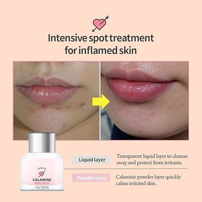 The YEON Refining Calamine Pink Spot 15ml
