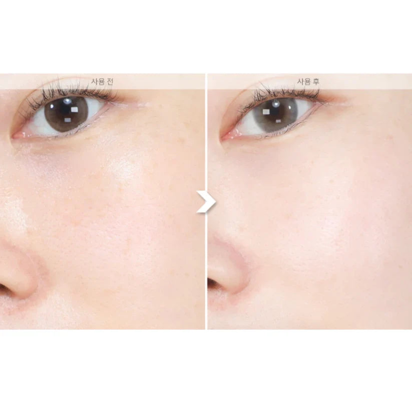 Sungboon 山葡萄維他命C 煙酰胺亮白淡斑精華 30ml