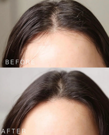 LABO-H Hair Loss Care Hair Line Ampoule Double 15ml