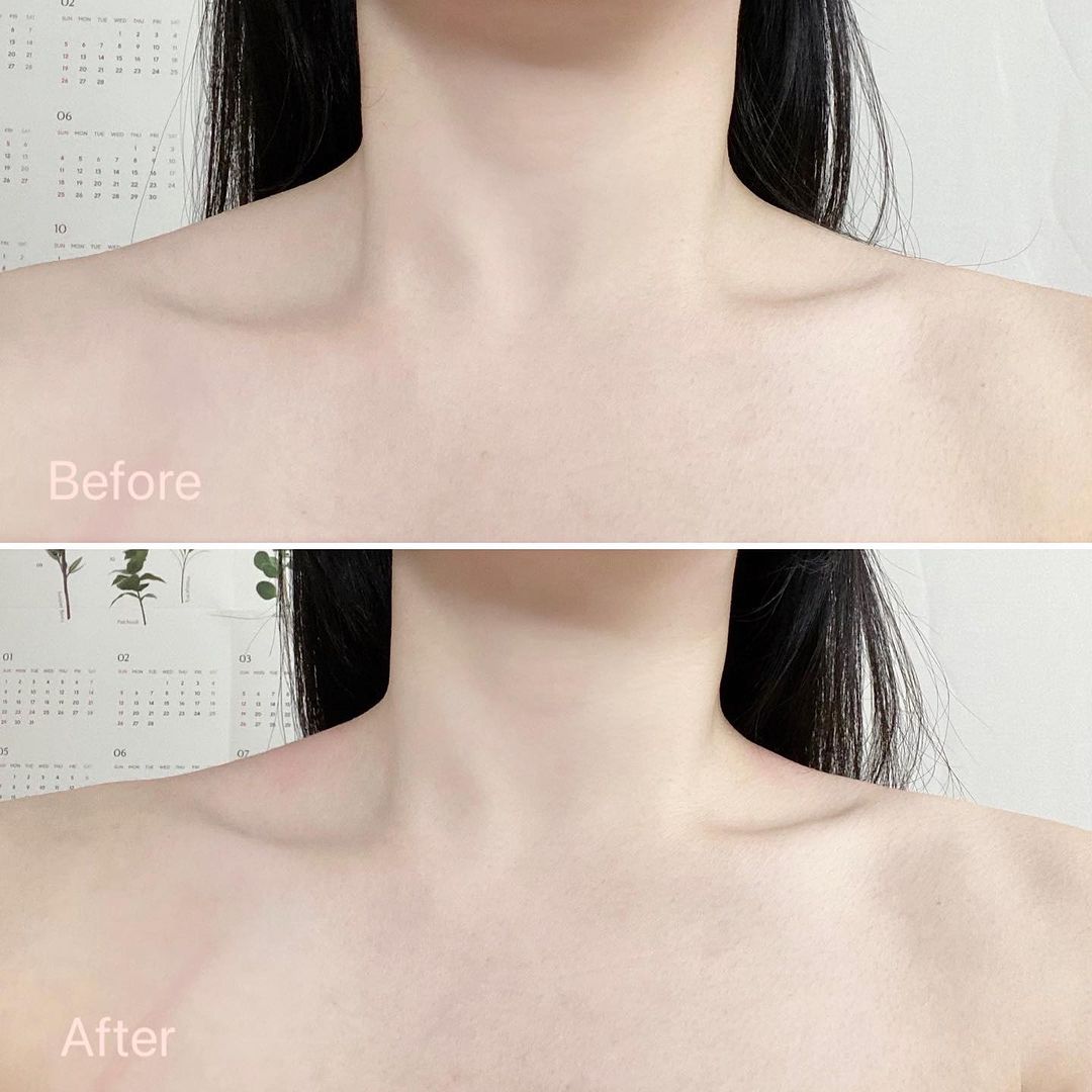 BeaumAnt Self Gua Sha Massager