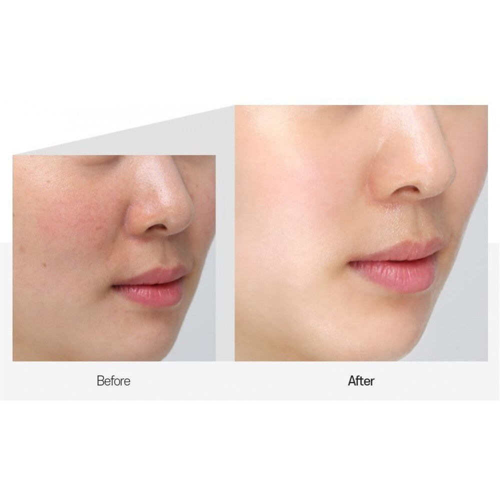 Medipeel 穀胱甘肽全效美白面霜 50g