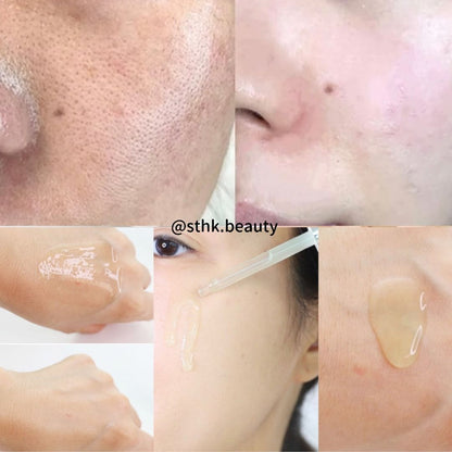 Sungboon Green Tomato Pore Lifting Ampoule Plus Set (30ml+30ml+10ml)