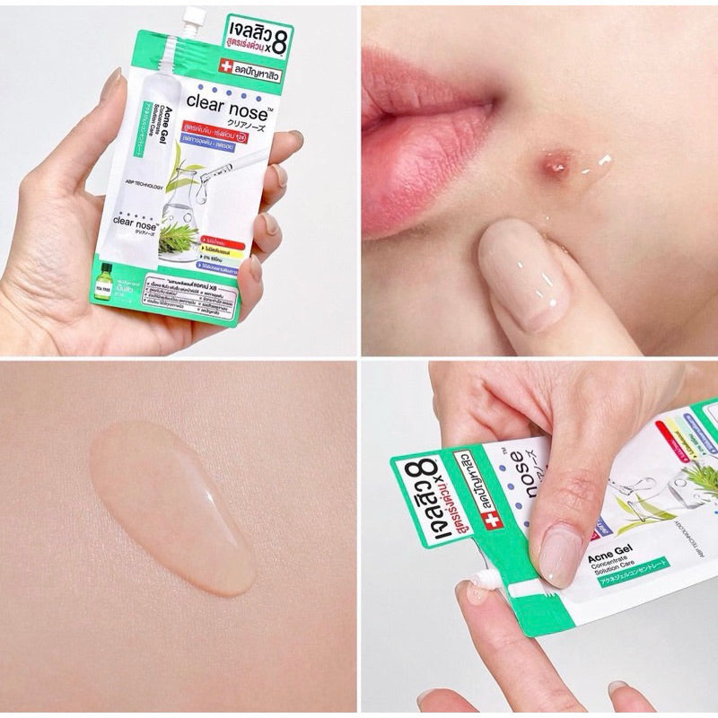 CLEAR NOSE Tea Tree Alcohol-Free Acne Gel Concentrate Solution 4g